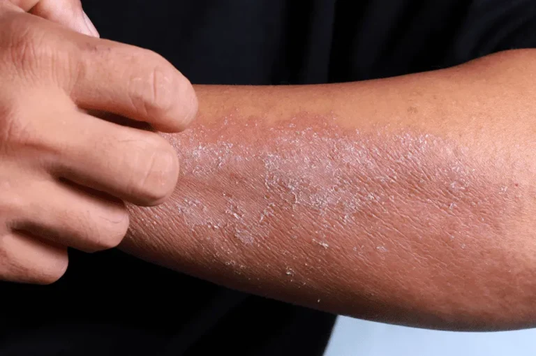 ماهي امراض القطط معدية للانسان وطرق الوقاية منها؟