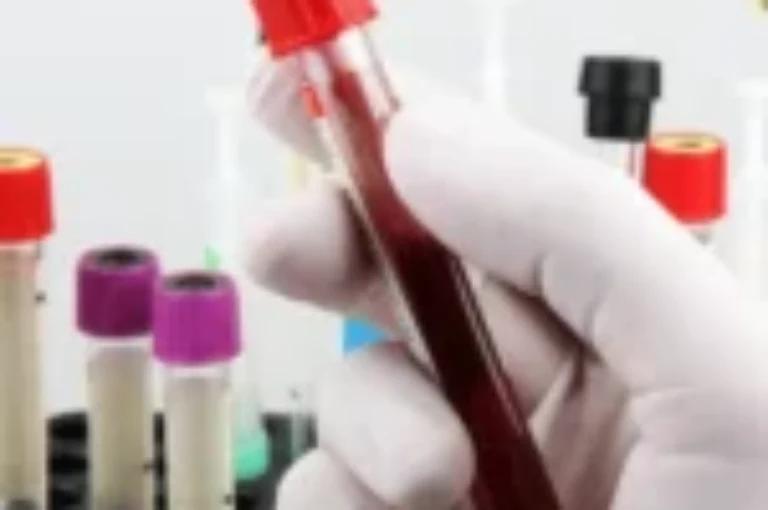 اسباب ارتفاع الكالسيوم في دم القطط ومعالجته