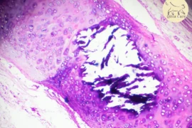 التهاب القصبات الهوائية المزمن عند القطط