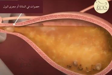 ما سبب حصوات أكسالات الكالسيوم في الجهاز البولي للقطط؟